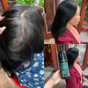 DẦU_GỘI_PHỦ_BẠC_LACO